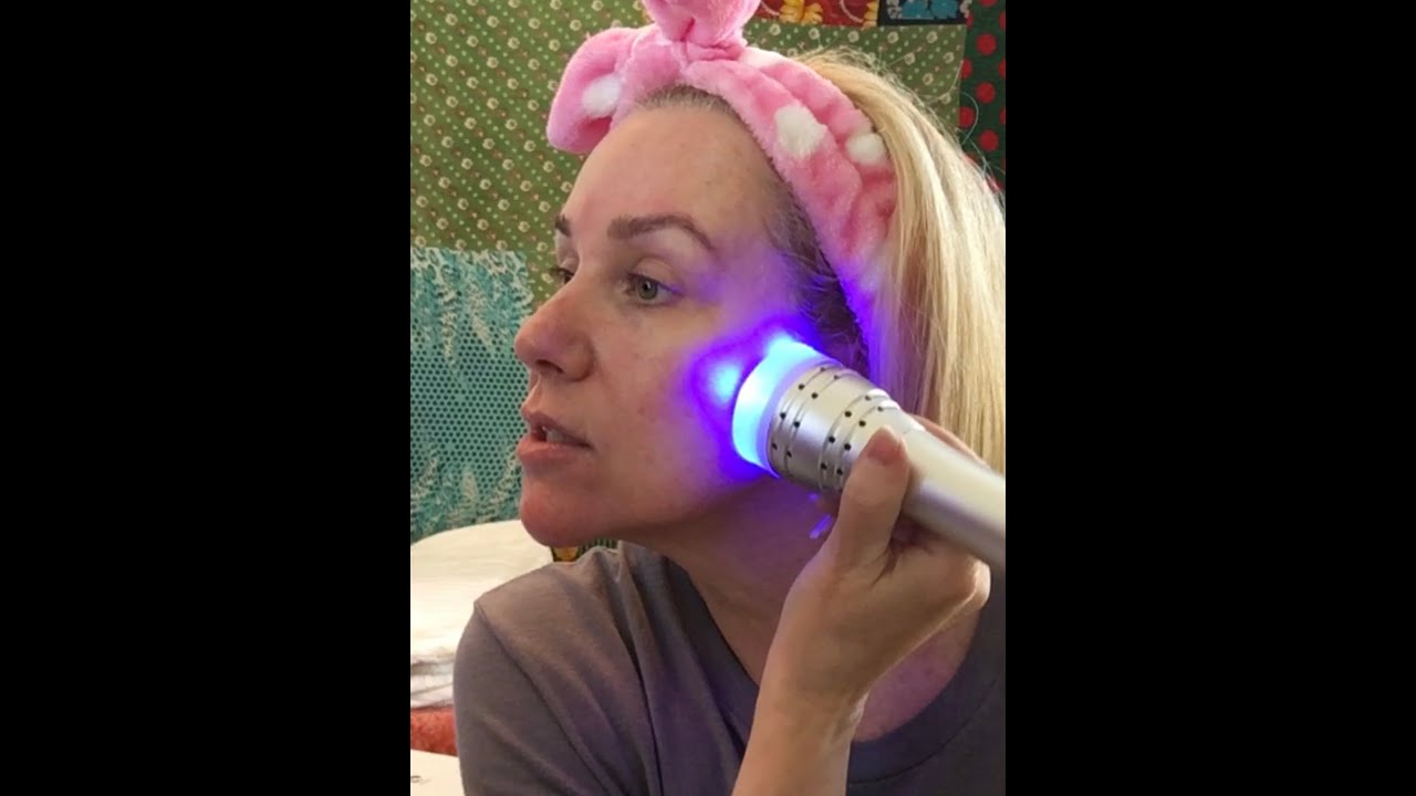 Zemits DermeLuxx Pro Full Product Review. My experience from start to finish