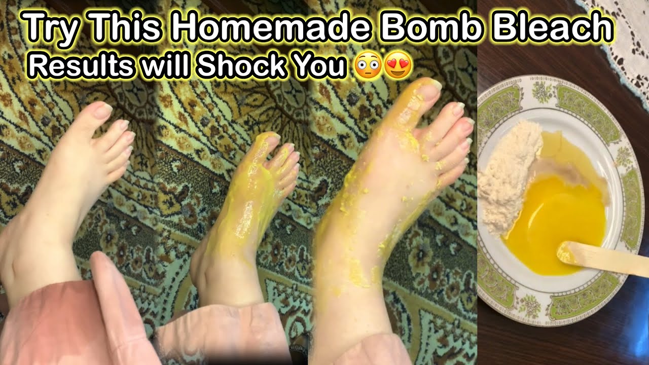 Try This Homemade Whitening Bomb Bleach | Results Will Shock You | Whitening Bleach & Skin Polish