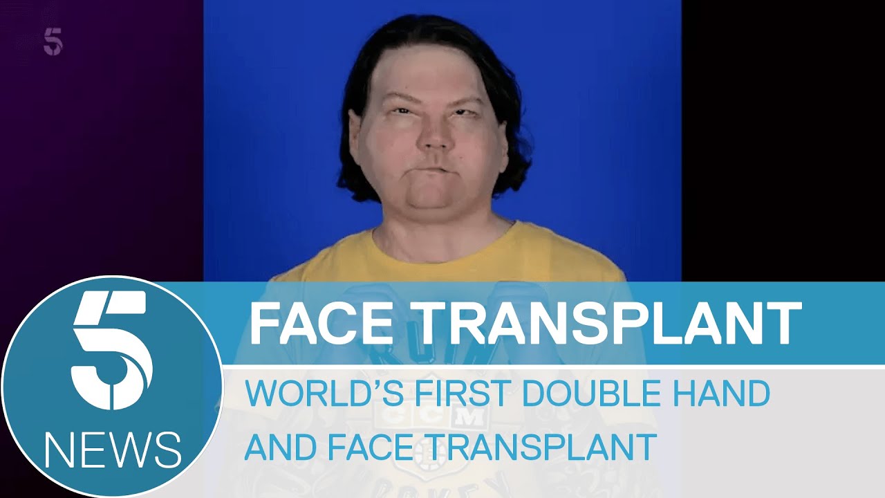 World&rsquo;s first successful double hand and face transplant | 5 News