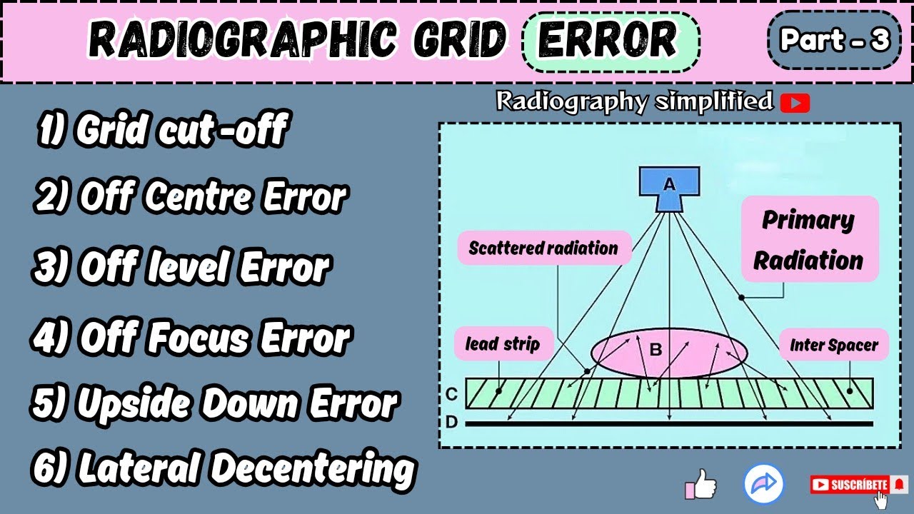 Grid Errors ll Anti Scattered Grid ( part -3 ) ll Radiography simplified ll