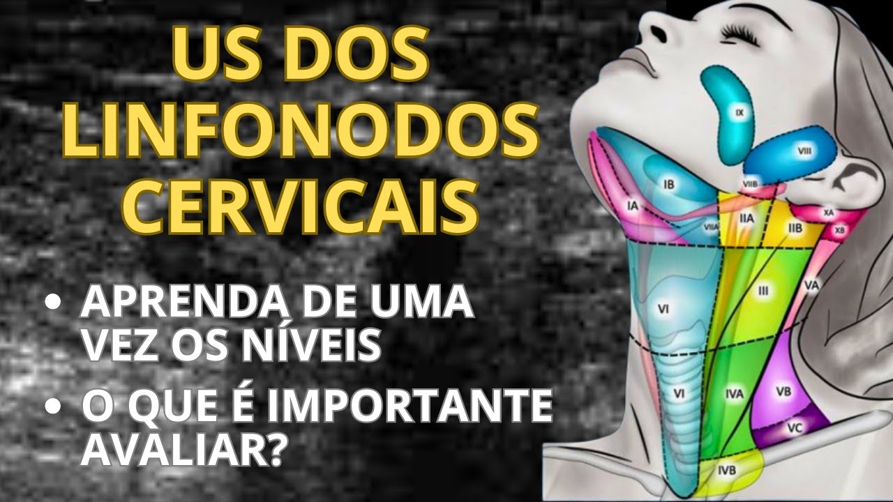 Pequeno Guia do US dos Linfonodos Cervicais