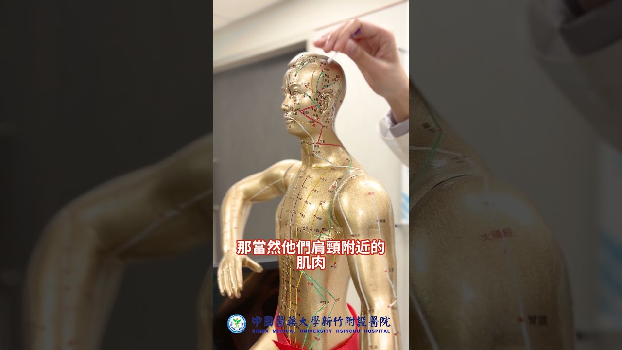 偏頭痛中醫針灸穴位大公開  #偏頭痛#穴道 #肩頸放鬆  #吳佩芸 #中醫#白露