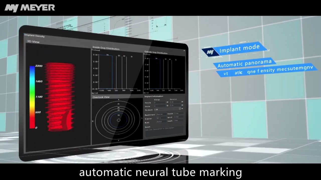 Myer CBCT Introduction Video
