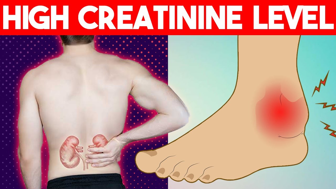 High Creatinine Levels: Common Symptoms and Causes of High creatinine levels you should know