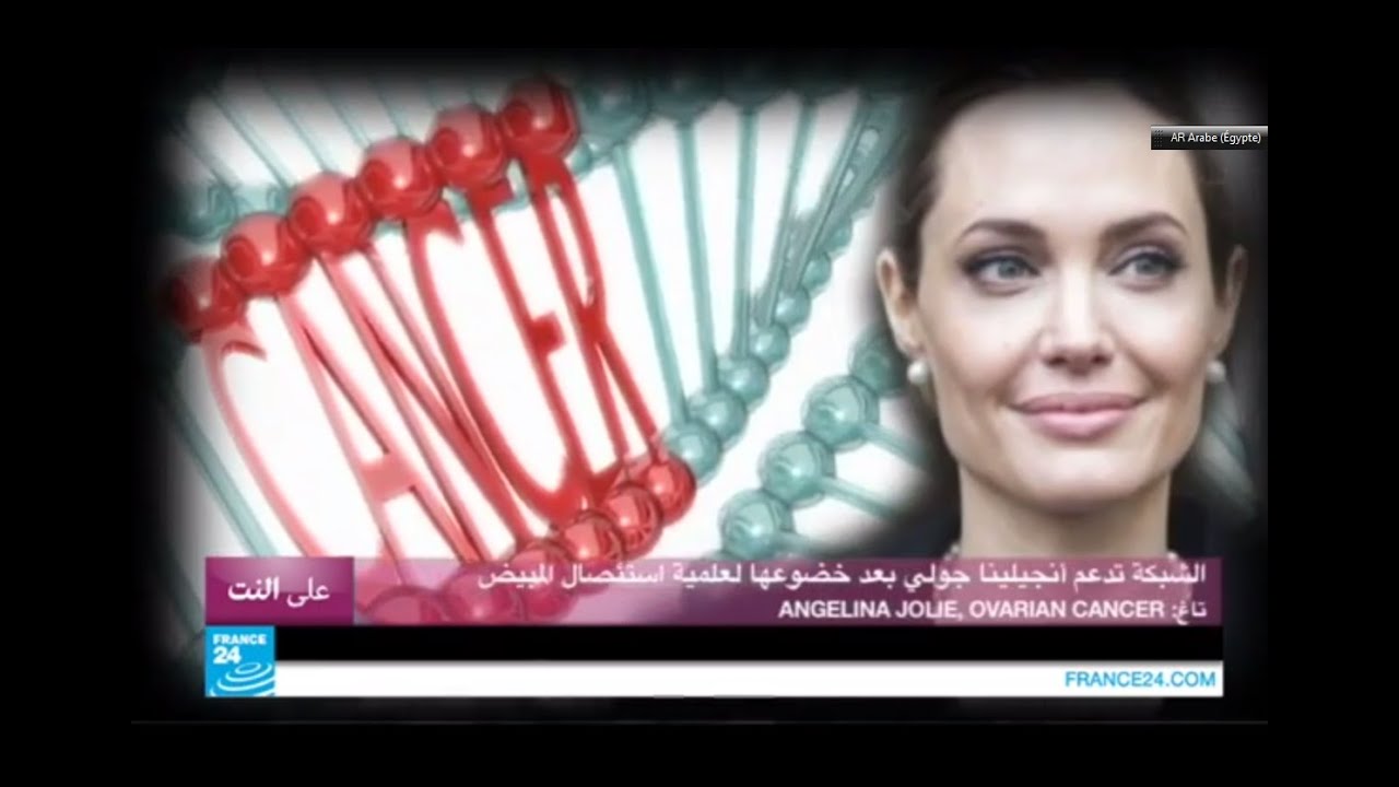 الشبكة تدعم أنجيلينا جولي بعد خضوعها لعملية استئصال المبيض