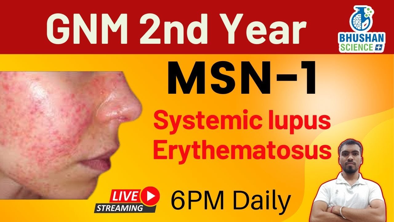 Systemic lupus erythematosus | MSN 1 | GNM 2nd Year | Bhushan Science Online Classes