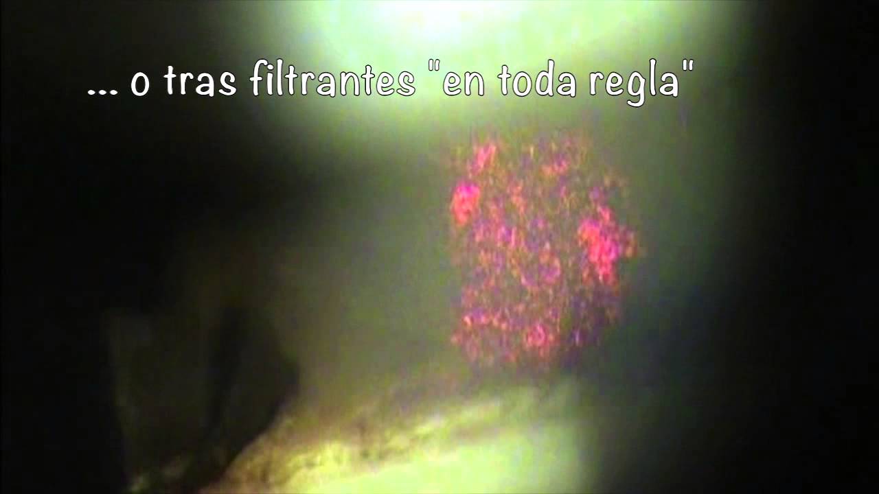 SLT detalles de la técnica