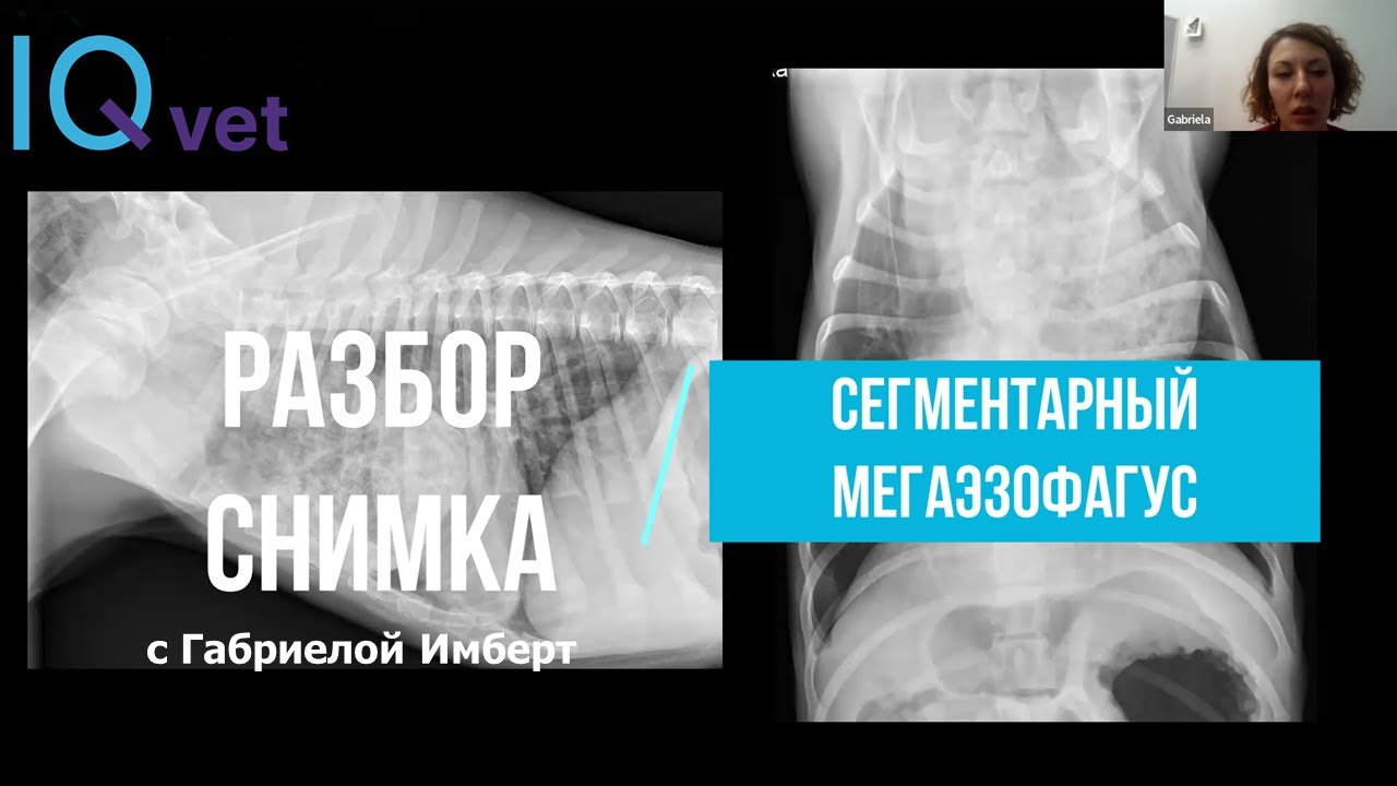 RR Case №17: Сегментарный мегаэзофагус - выясняем причину