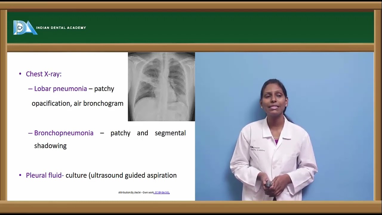 Pneumonia | chronic obstructive pulmonary Disease |General Medicine | #NEET#MDS#BDS#NBDE#ORE#DDS