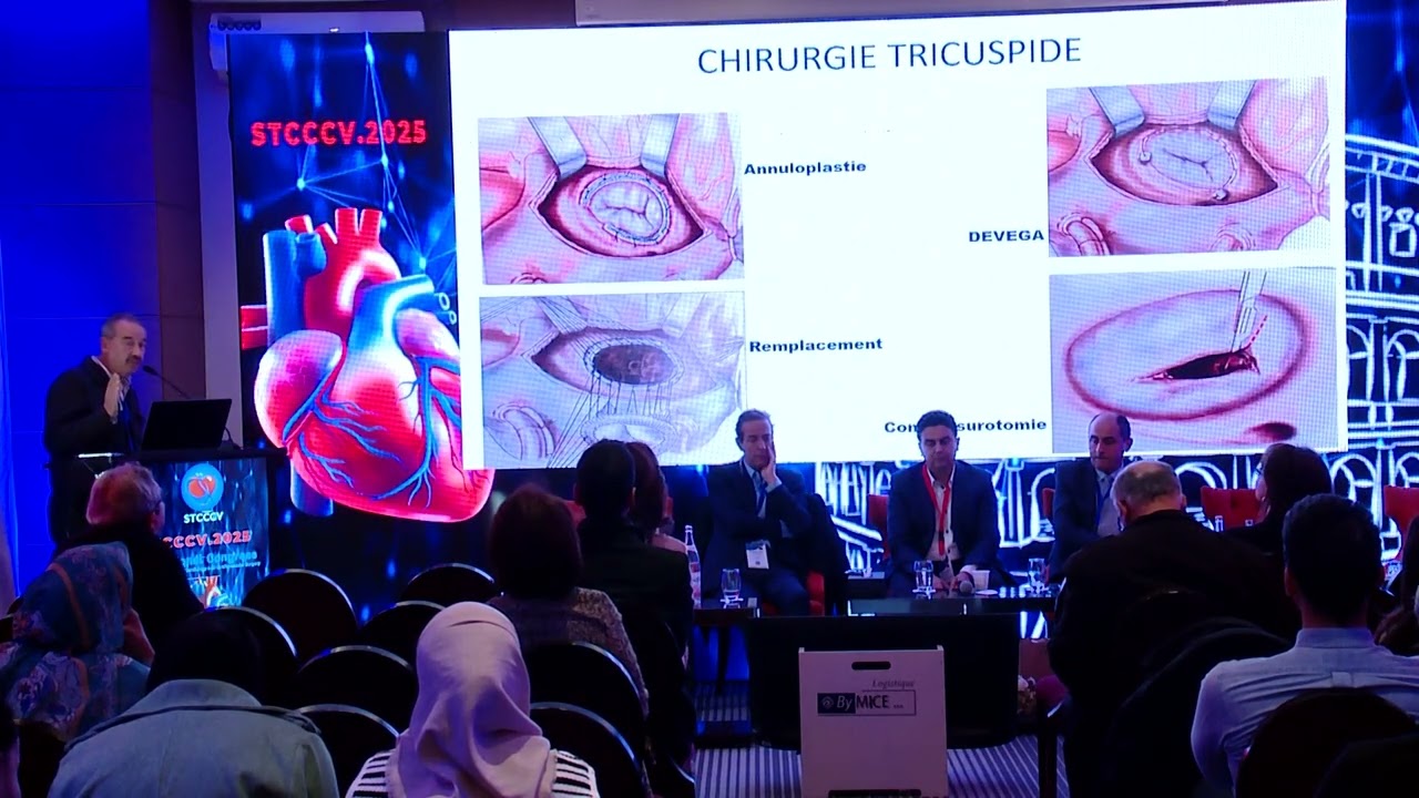 STCCCV-2025-Surgical outcomes in multivalvular patients : the tunisian experience-R  Denguir