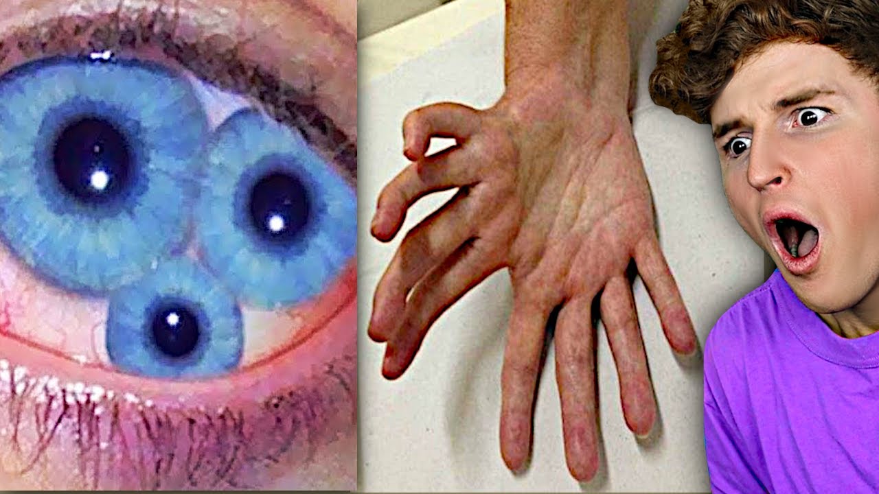 The RAREST Human Features Only 2% Of People Have..