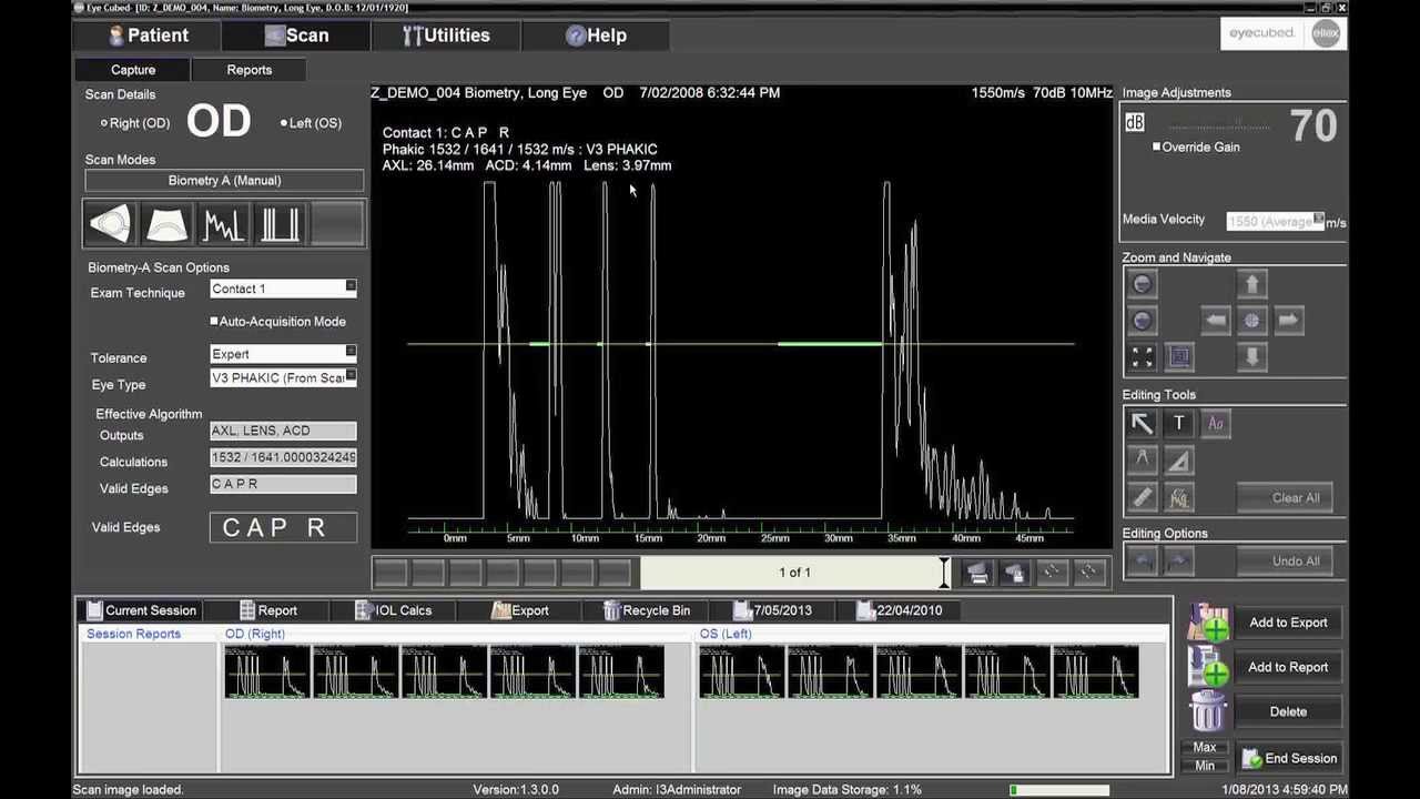 Performing IOL Calculations with the Ellex Eye Cubed