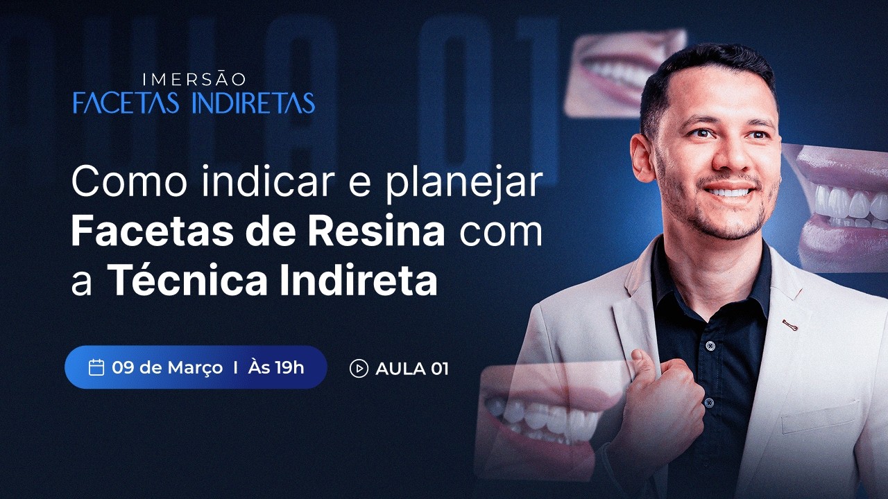AULA 01: COMO INDICAR E PLANEJAR FACETAS DE RESINA COM A TÉCNICA INDIRETA
