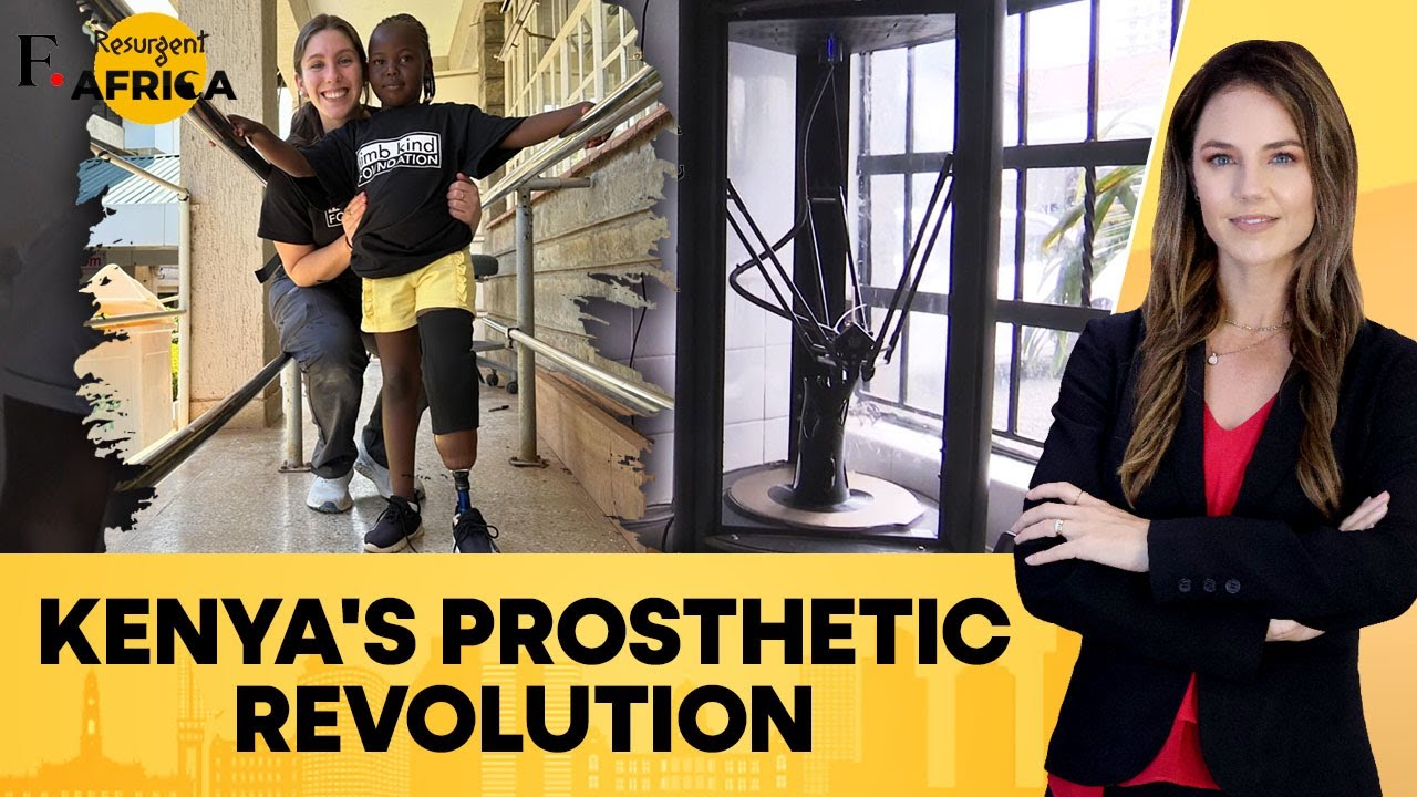Kenya: Nairobi Clinic Transforms Prosthetic Care With 3D Printing | Firstpost Africa