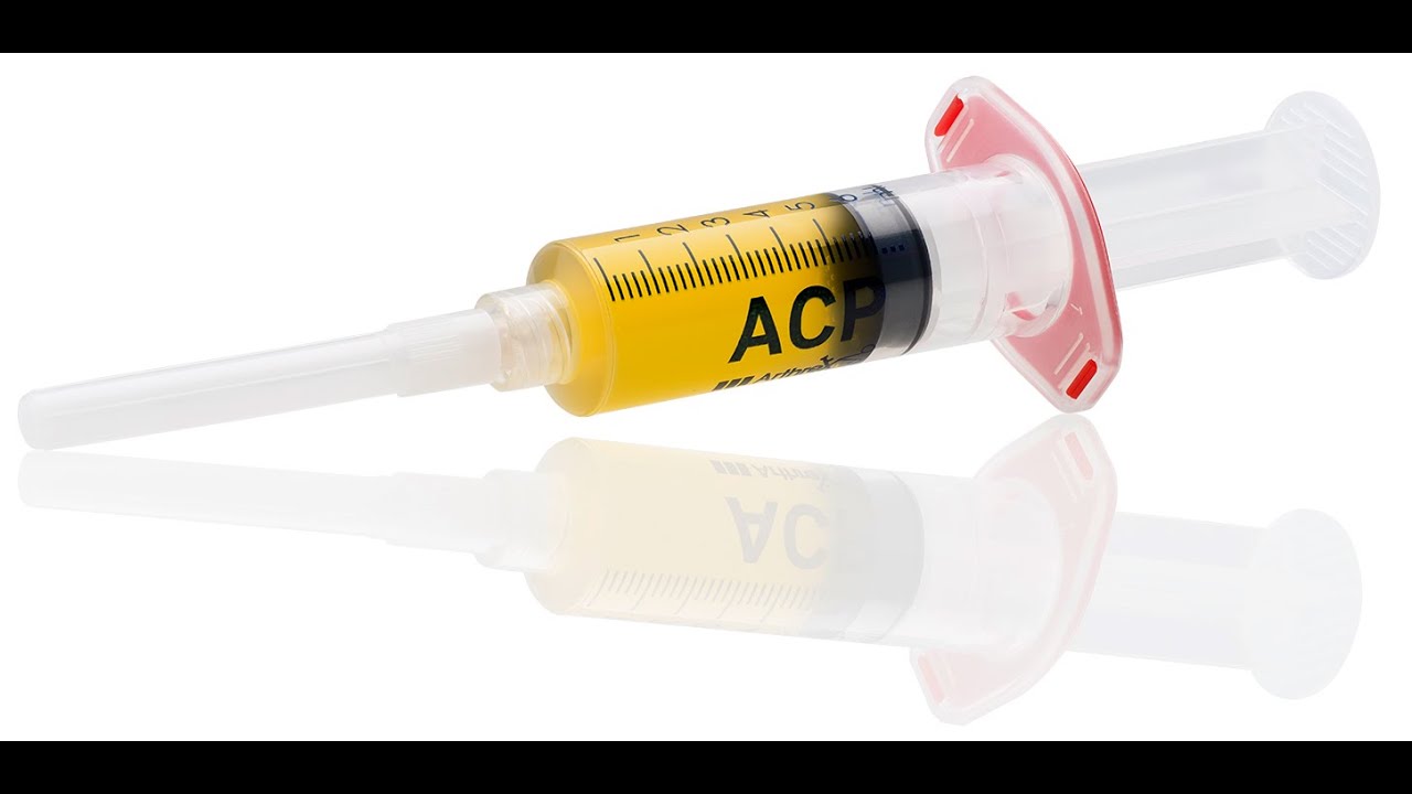 Spritzenbehandlung (Injektionstherapie) bei Abnutzungserscheinungen der Gelenke (Arthrose)