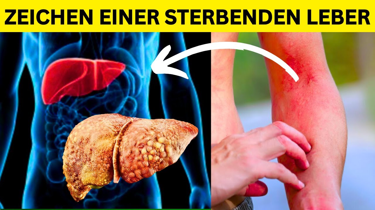 9 Warnsignale f&uuml;r Leberprobleme Erkennen, Vorbeugen und Behandeln