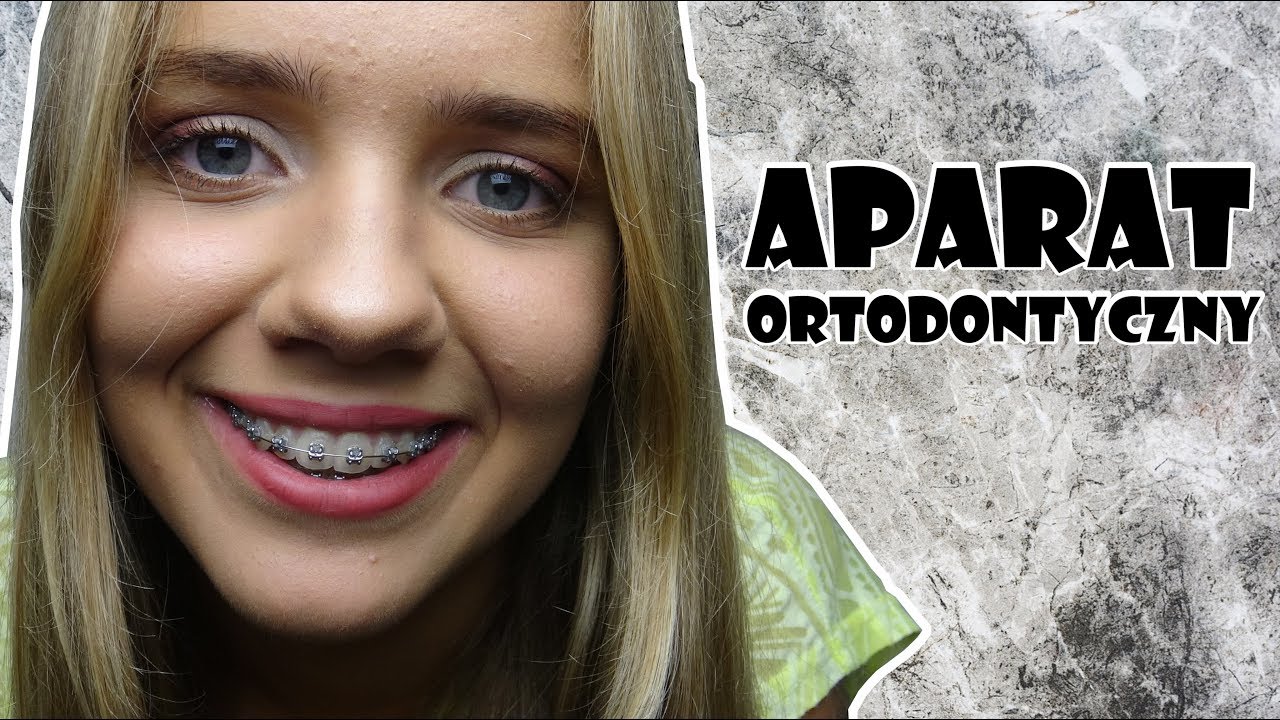 APARAT ORTODONTYCZNY - cała prawda!