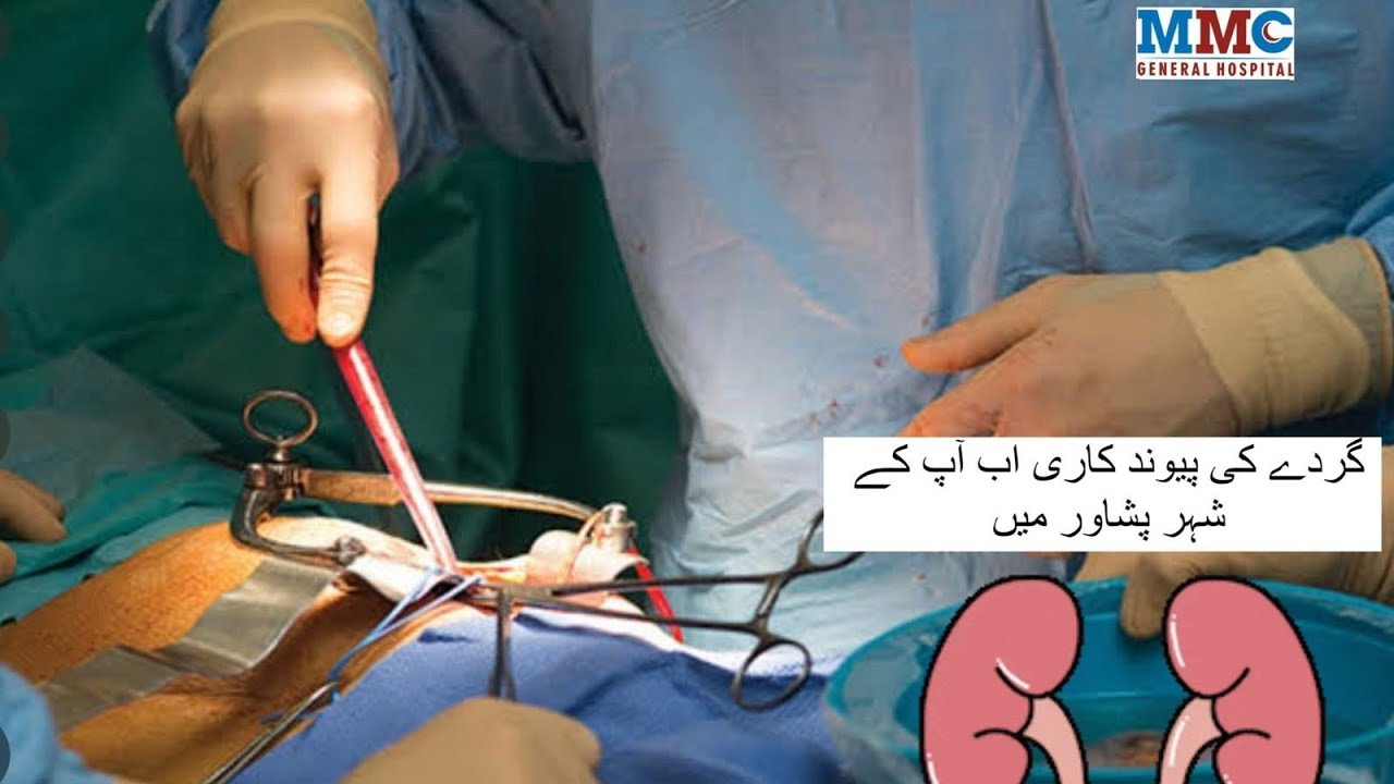 Prof Dr Atta ur Rehman | Kidney Transplant Surgeon | Peshawar | MMC