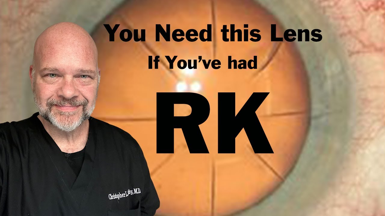 Had RK? Don't Get Cataract Surgery Without Watching This!