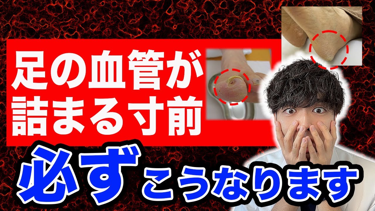 足の血管が詰まる直前に出る４つの危険サイン、必ずこうなります。【なぜ報道しない？】