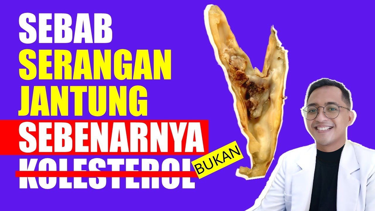 Penyebab Serangan Jantung yang Sebenarnya Terungkap! BUKAN KOLESTEROL! Lakukan Ini Untuk Mencegahnya
