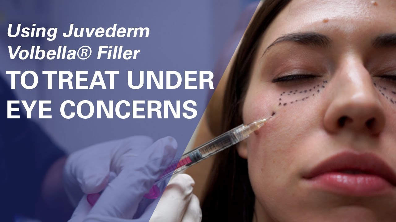 Using Juvederm  Volbella&reg; Filler To Treat Under-Eye Concerns at ZO Skin Centre