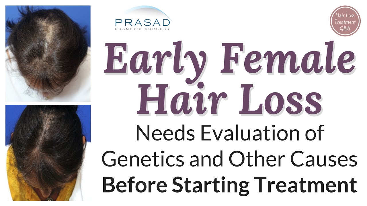 Treating Difficult Female Pattern Hair Loss Successfully in Over 99% of Patients