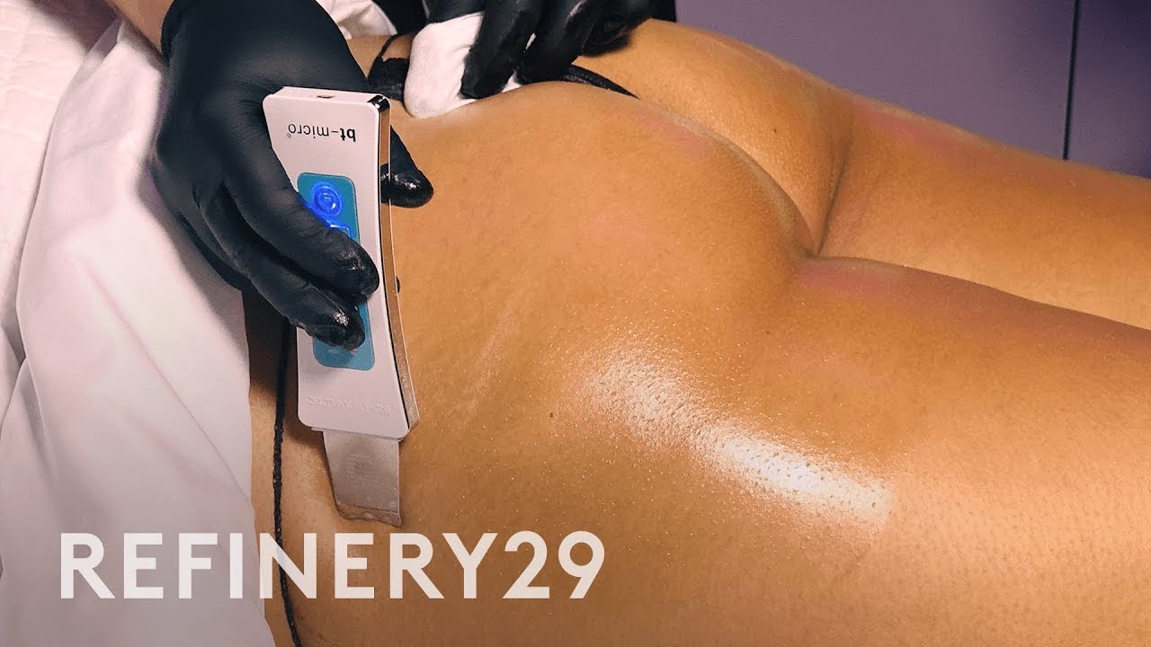 I Tried a $295 Butt and Back Facial: Is It Worth It? | Macro Beauty