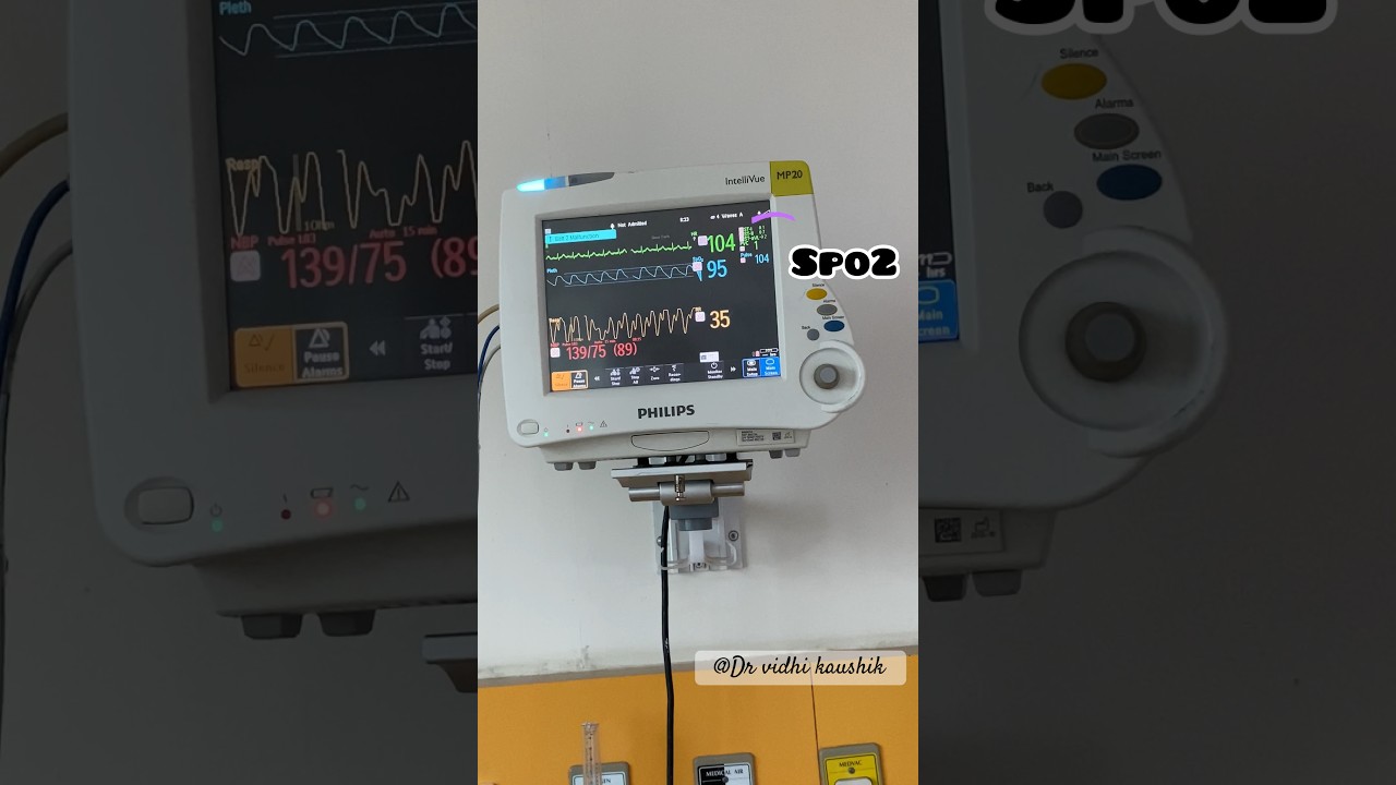 Icu screen monitoring vitals #icu #ventilator #medical #shortfeed #ytshorts #drvidhikaushik