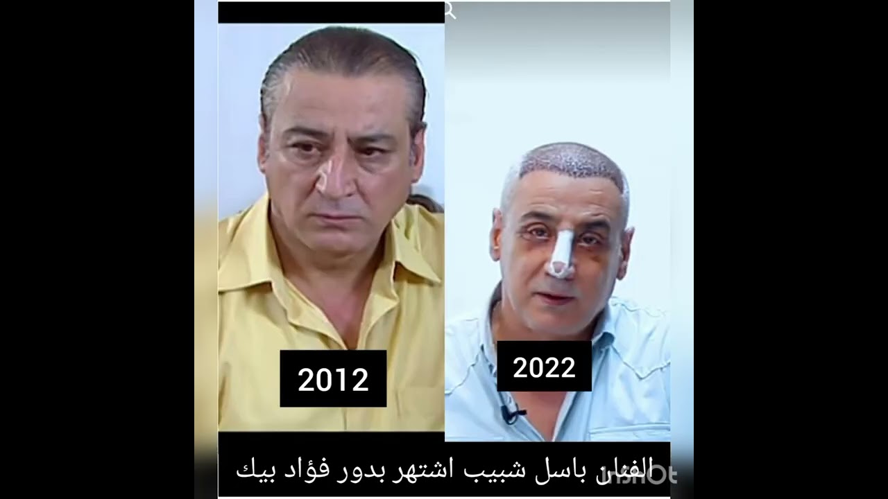 أبطال مسلسل باب الشيخ بعد مرور ١١عام كيف اصبح شكلهم #_ادخل #_الوصف