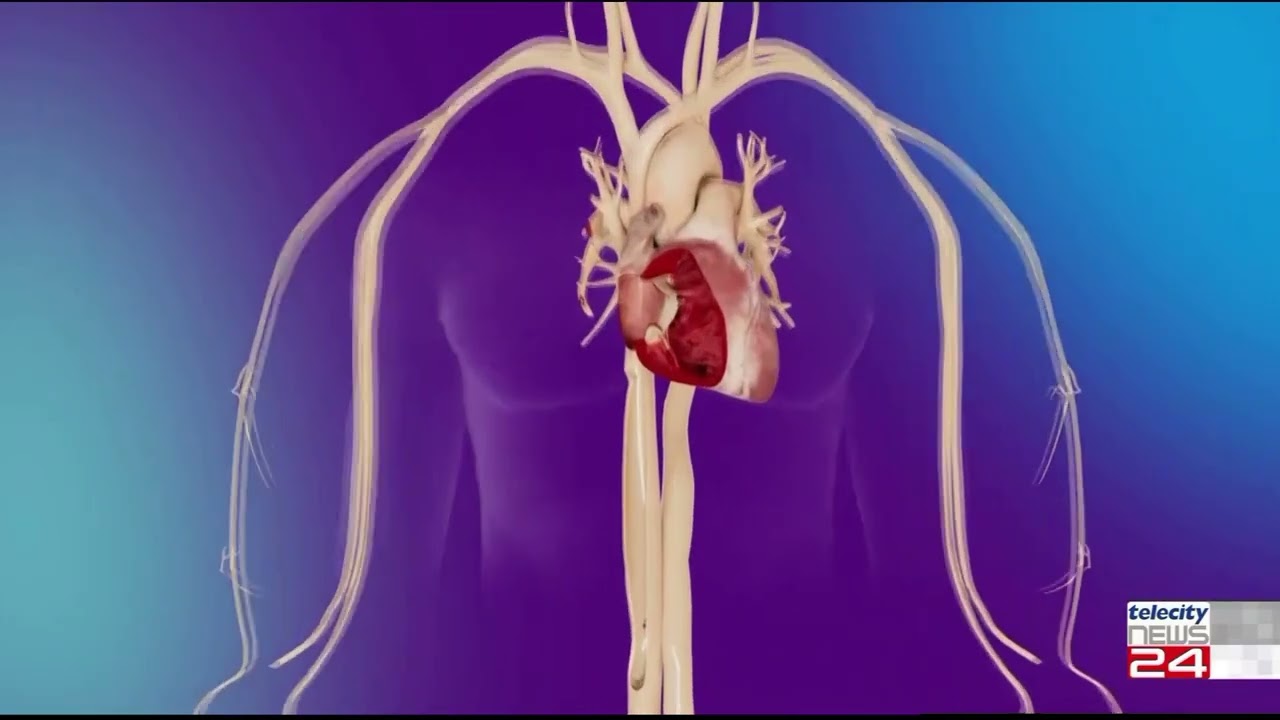 30/01/24 - Cardiologia Cirie', fra le prime ad impiantare un pacemaker senza fili