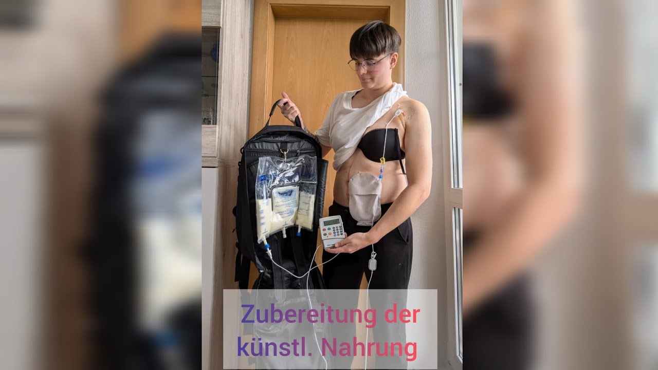 Parenterale Ernährung | Zubereitung | Port | Kurzdarmsyndrom