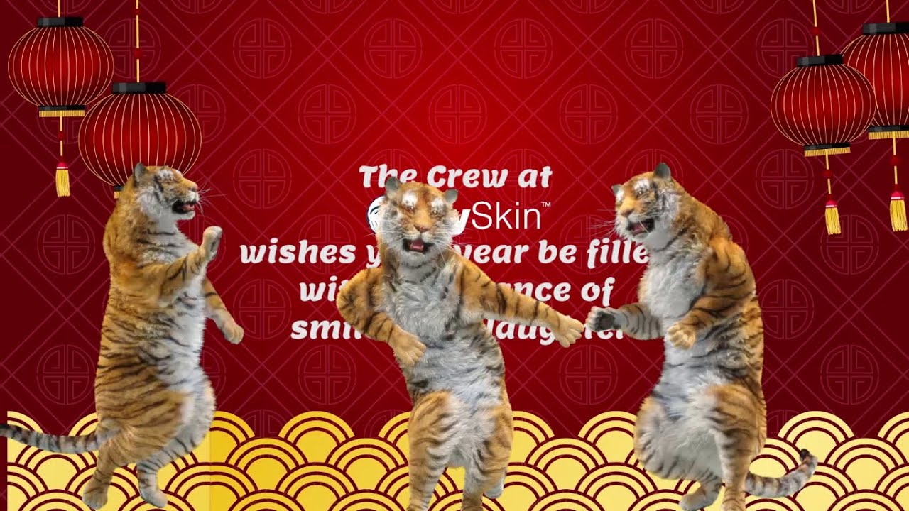 Animated Chinese New Year Tiger Dance | MySkin&trade; Centre for Men