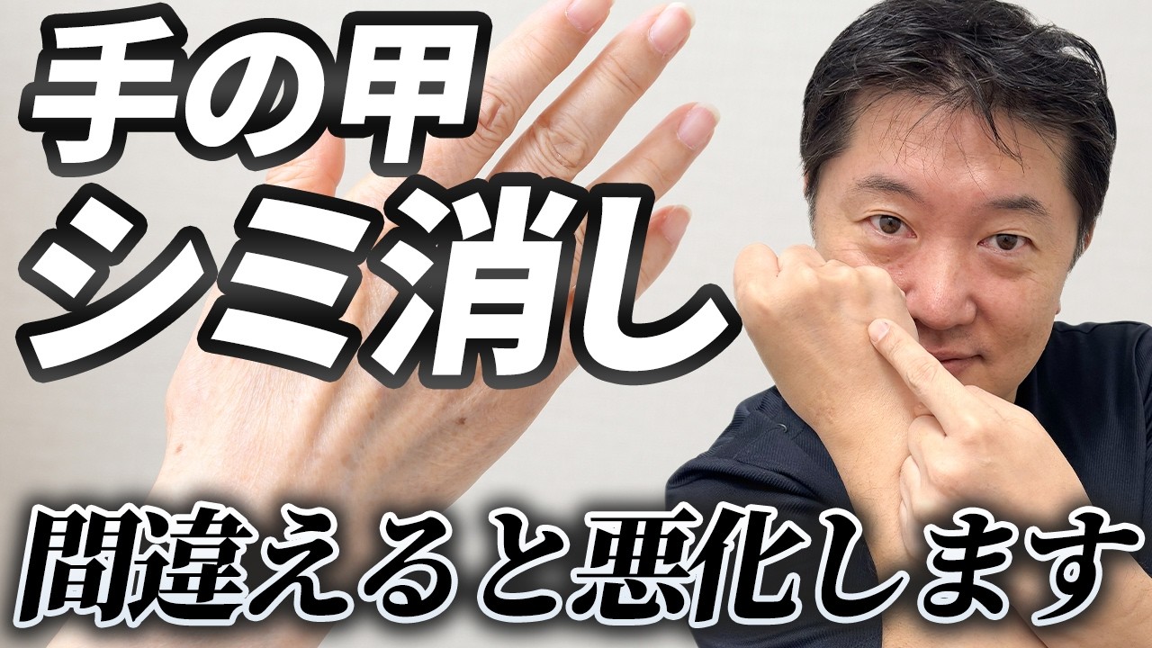 【手の甲のシミ】皮膚科専門医が消し方を解説します！