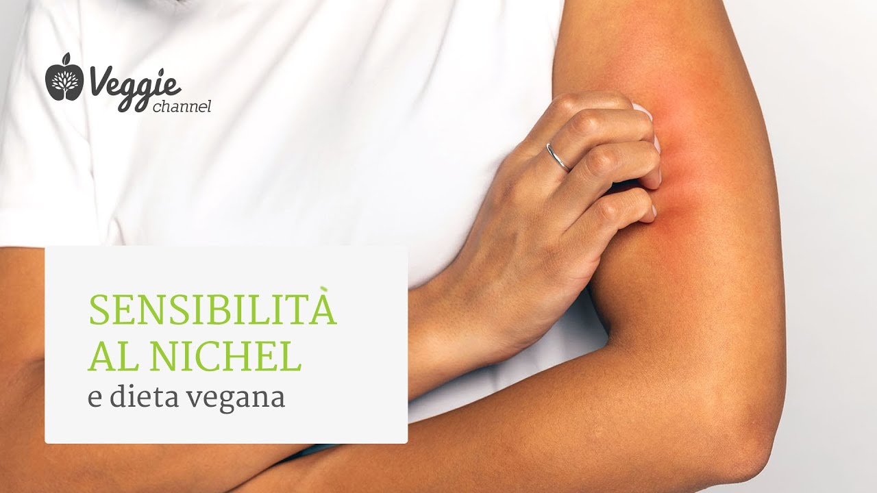 Sensibilit&agrave; al nichel e dieta vegana - Dott.ssa Silvia Goggi