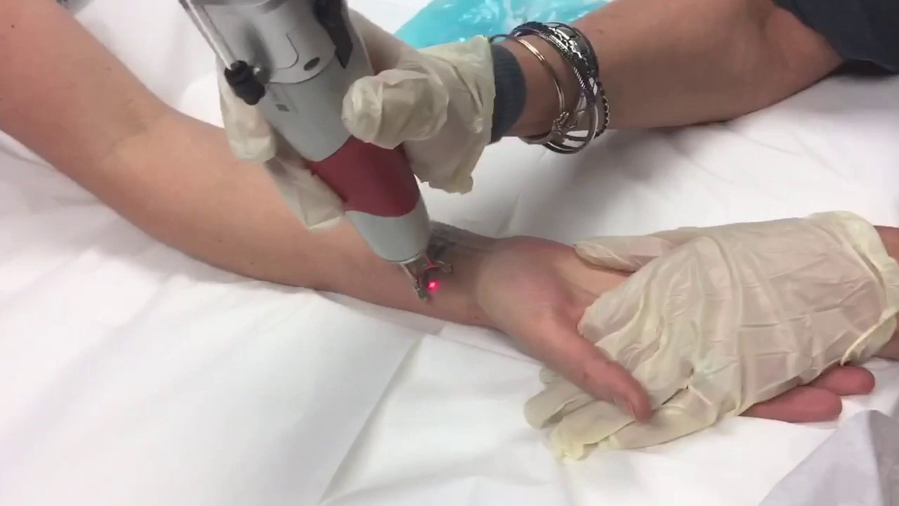 Tattoo Removal Training at National Laser Institute