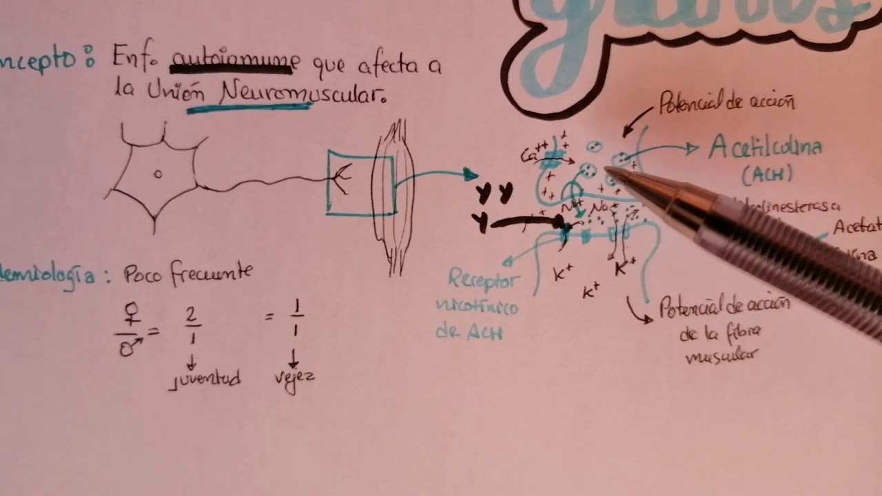 MAPIMEDIC | Miastenia Gravis Lo más básico.