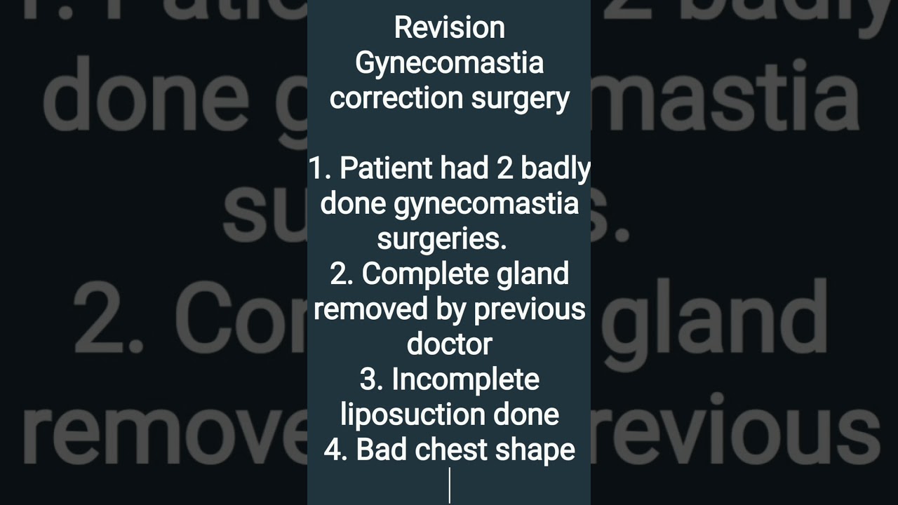 Revision of a Badly Done Lipo and Gland Removal for #Gynecomastia Done Somewhere