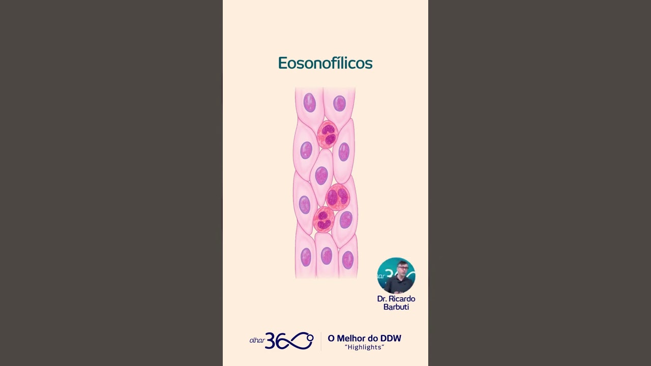 Eosin&oacute;filos