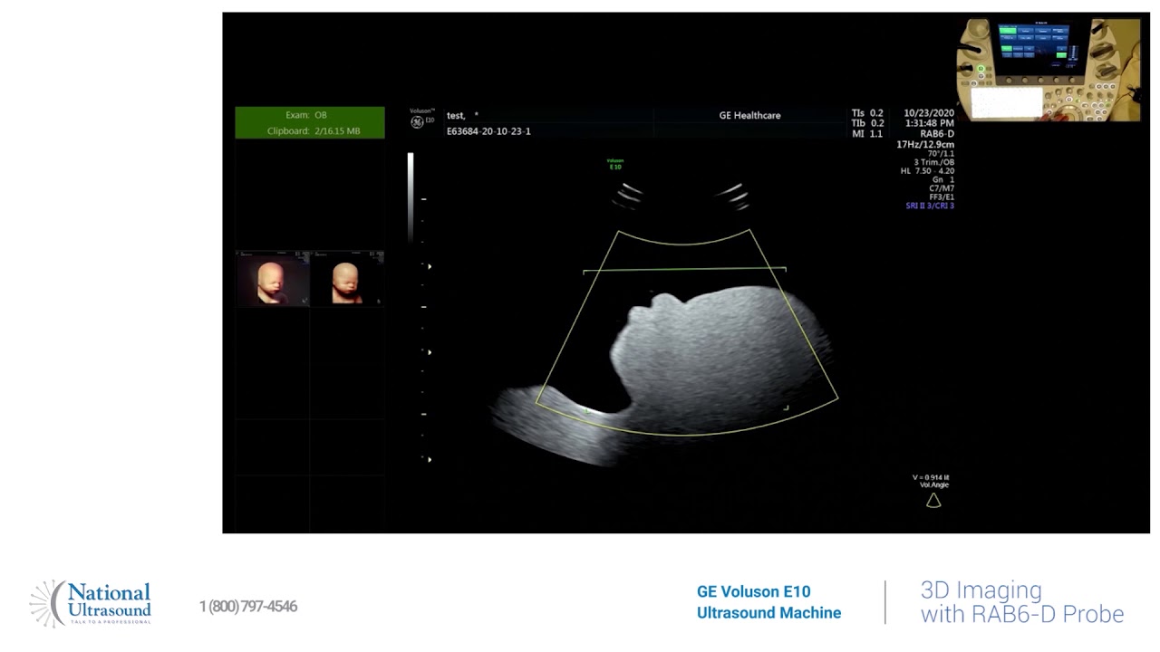GE Voluson E10 3D Imaging Training Video Demonstration
