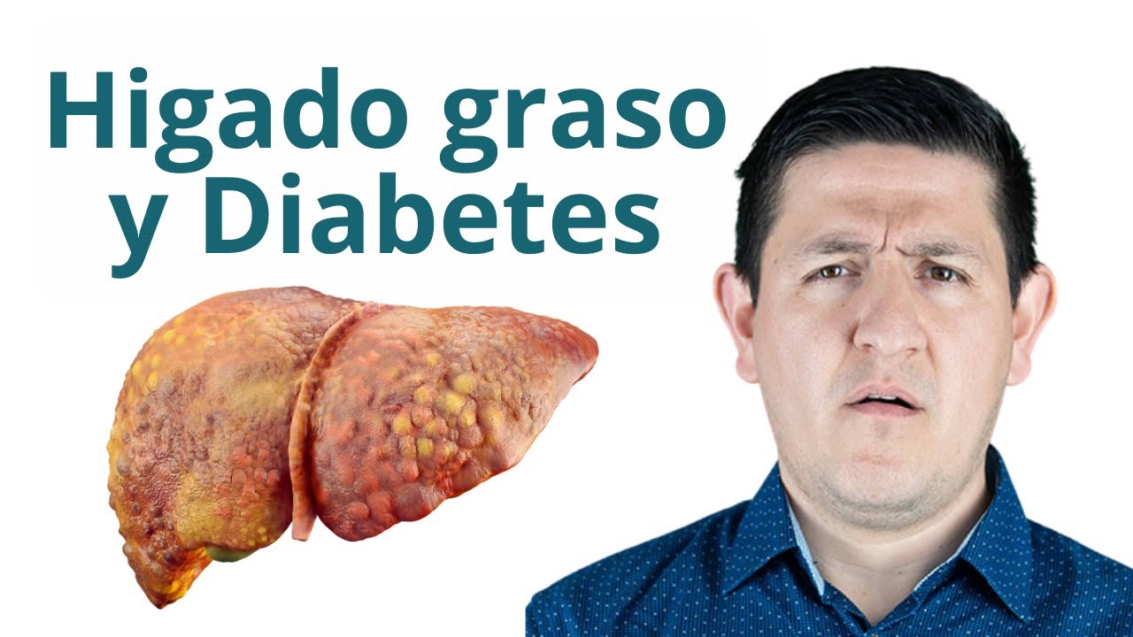 Hígado graso y diabetes: La conexión OCULTA que debes conocer