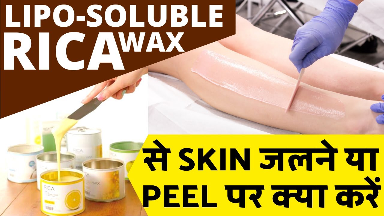 RICA Wax SKIN Burn, जलने या SKIN Peel  पर क्या करें SALON में | #ricawax #skin #peel