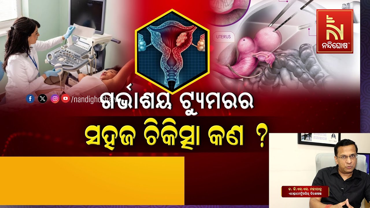 Uterine Fibroids: Causes, Symptoms & Treatment | Dr. G.S.S Mohapatra | Swasthyasutra