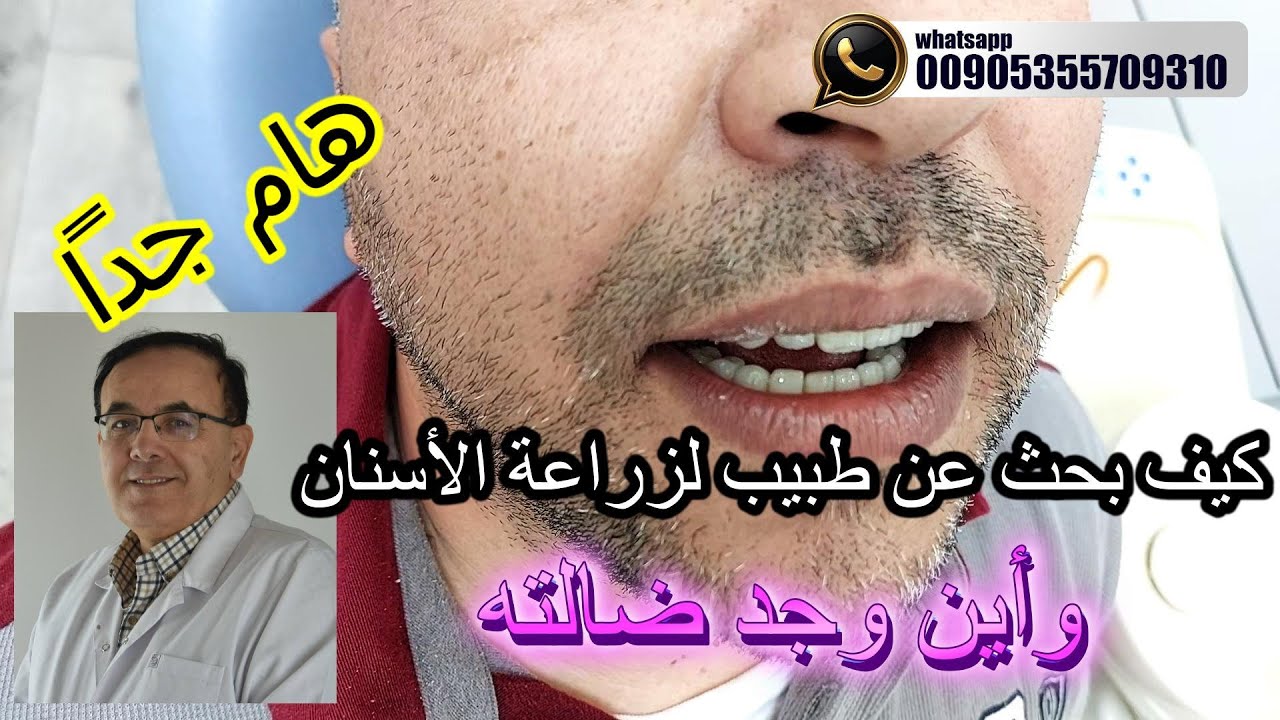 كيف بحث عن طبيب لزراعة الأسنان وكيف و جد الأفضل