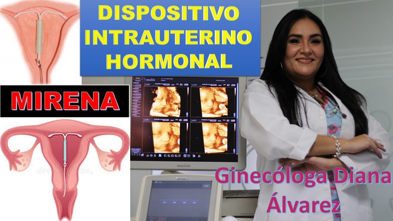 DISPOSITIVO INTRAUTERINO HORMONAL, por GINECOLOGA DIANA ALVAREZ