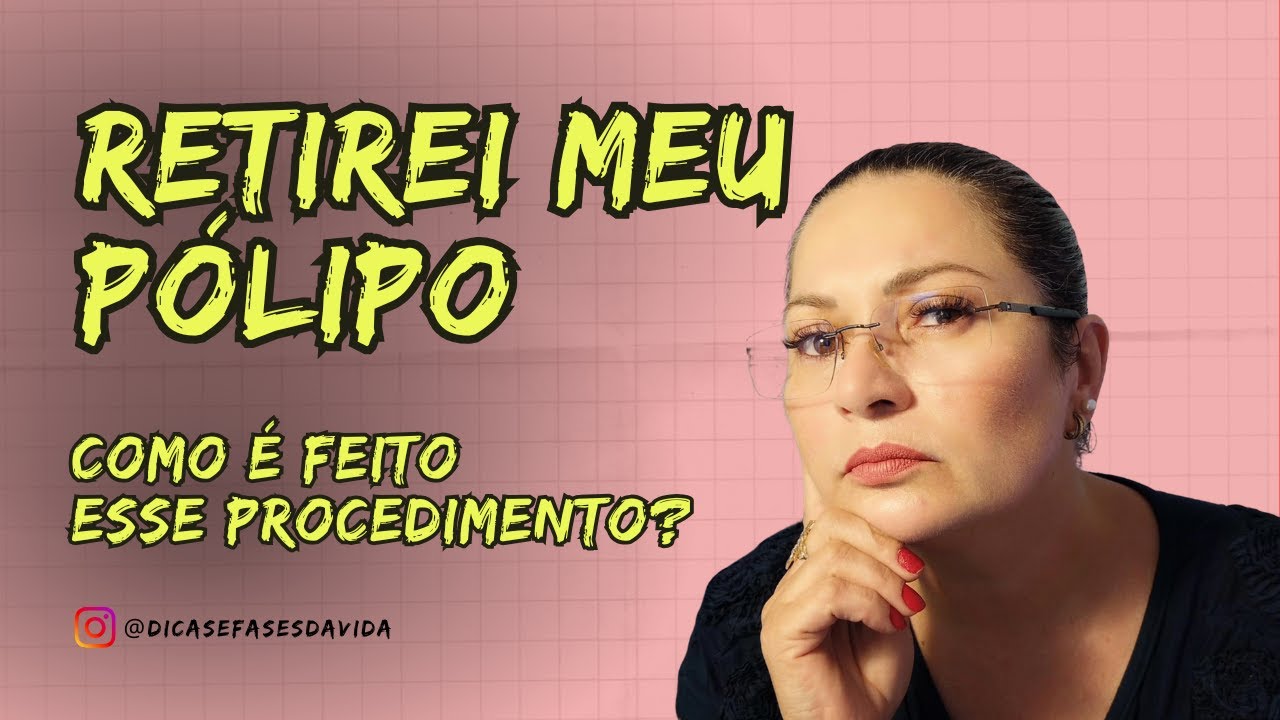 RETIREI MEU PÓLIPO - Como é feito o Procedimento?