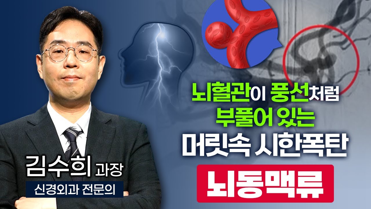 풍선처럼 부풀어 오르는 뇌혈관 '뇌동맥류' 갑자기 발생한 '극심한 두통'이 있다면 의심하라.. / 부산mbc tv닥터인사이드 220808 방송
