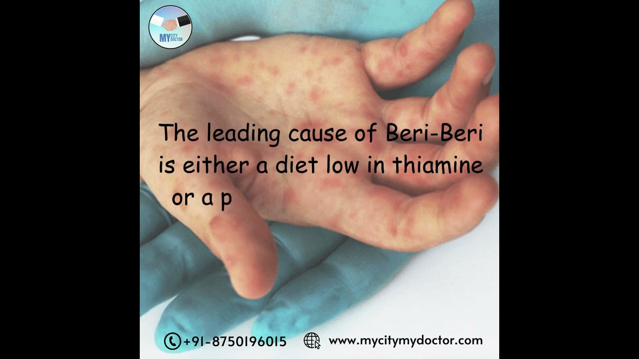 Have you heard of Beri Beri???