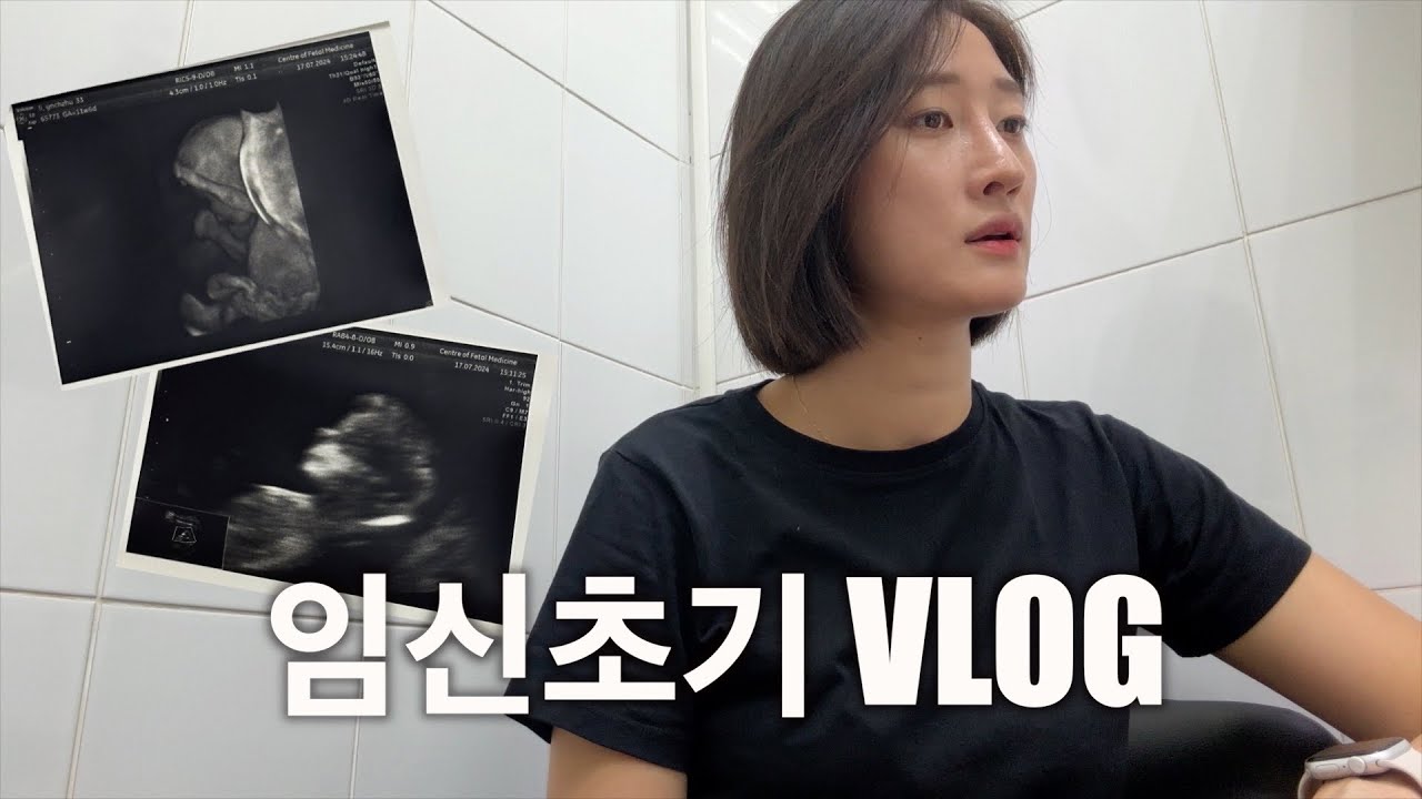 임신초기 VLOG | 임신도, 러시아 산부인과도 처음인걸요.. | 심경변화 | 태명과 이유 | 해외 산부인과