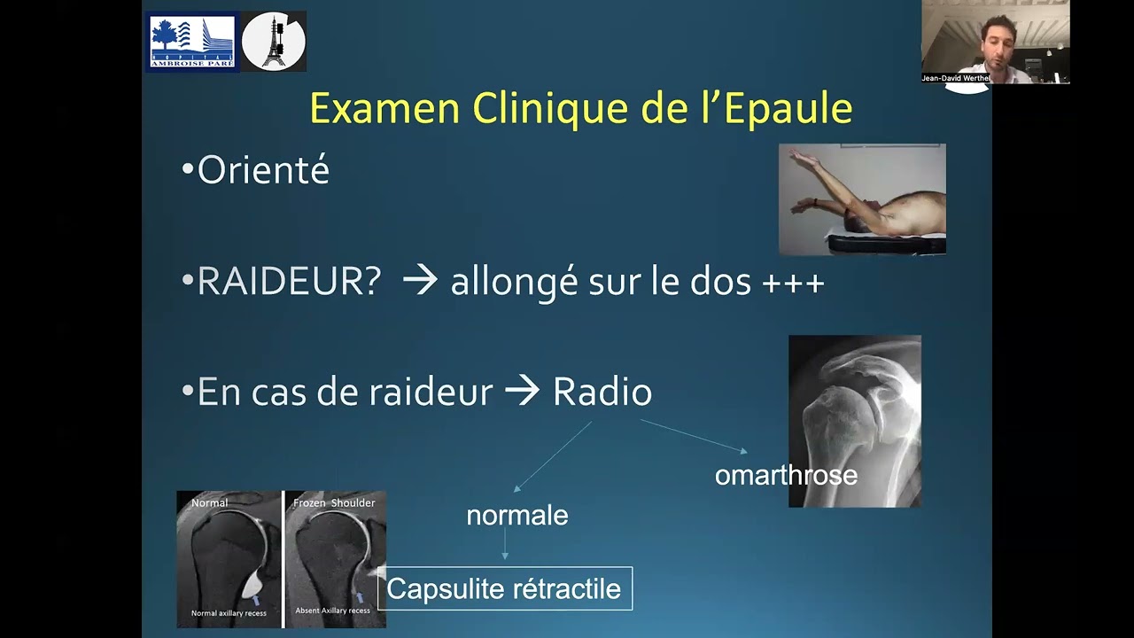 7/ Rupture transfixiante SSP / ISP : indications : JD Werthel